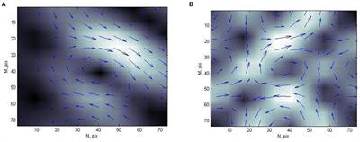 Multistage Classification of Current Density Distribution Maps of Various Heart States Based on Correlation Analysis and k-NN Algorithm